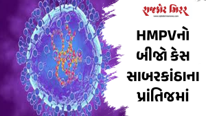 HMPVનો બીજો કેસ સાબરકાંઠાના પ્રાંતિજમાં